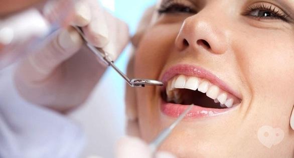 Акция - Скидка на вживление импланта от "Сучасна сімейна стоматологія"