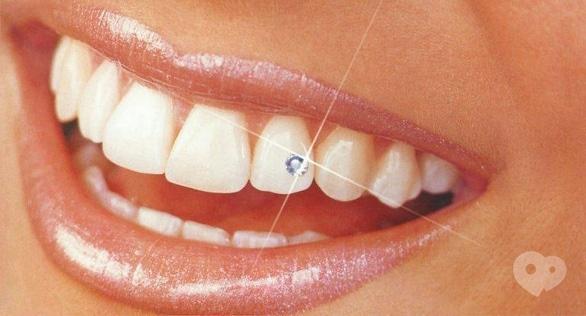 Акция - Бриллиант на зуб по новогодней скидке от "Сучасна Сімейна Стоматологія"