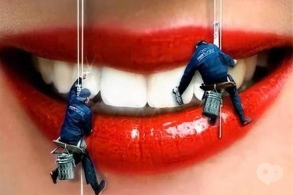 Акція – Весняна знижка на SPA-процедуру для зубів в "Smileup"